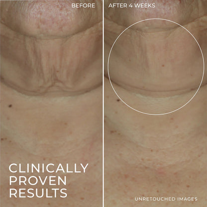 Illurea™ Firming Serum Stick