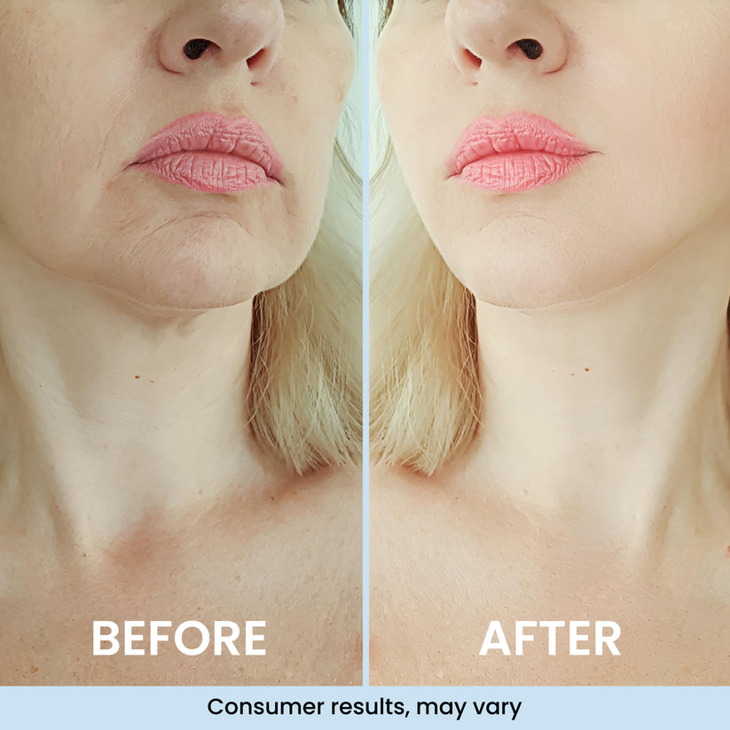 Illurea™ Ultra Hydrating Serum
