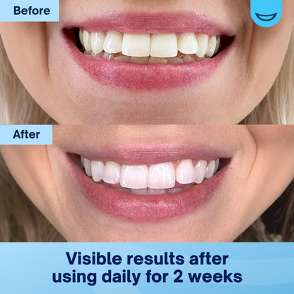 Illurea™ Whitening Powder