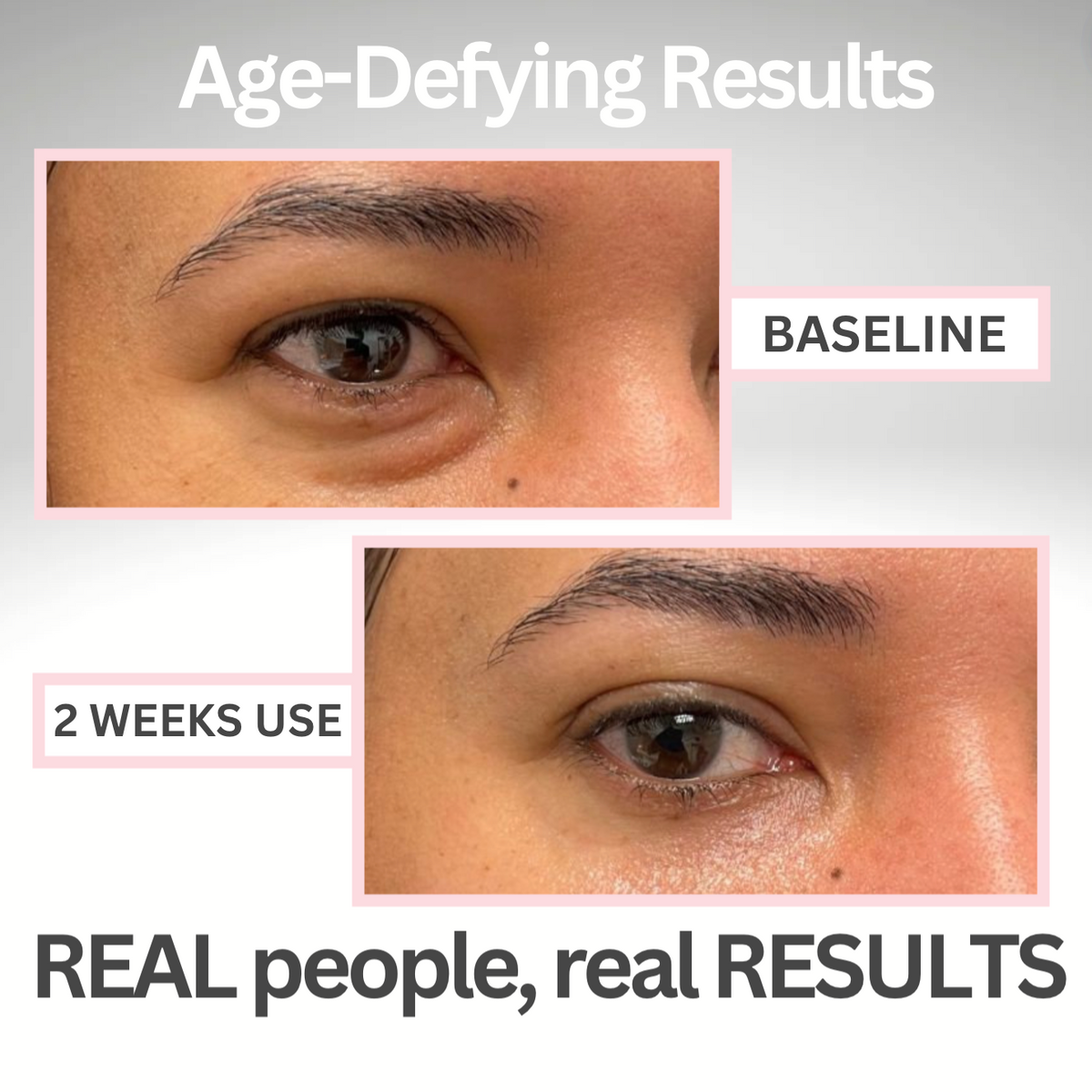 Illurea™ Eye Roller