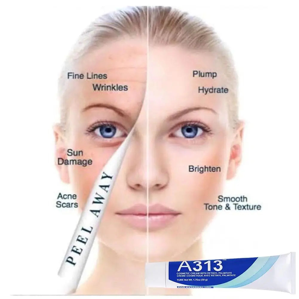 Illurea™ A313 Skin Revival Cream
