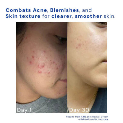 Illurea™ A313 Skin Revival Cream