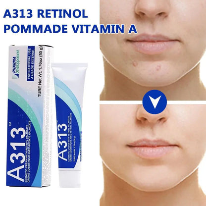 Illurea™ A313 Skin Revival Cream