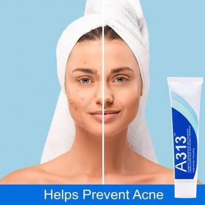 Illurea™ A313 Skin Revival Cream